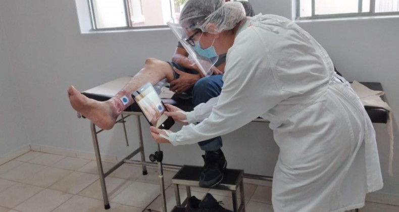 Goiás revoluciona tratamento de feridas crônicas com tecnologia inovadora